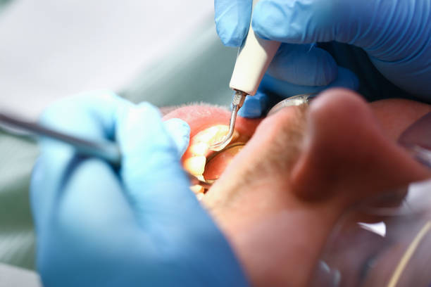Best Emergency Dental Surgery in Suffield Depot, CT